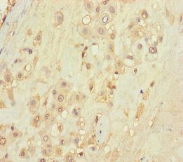 TLN2 Antibody