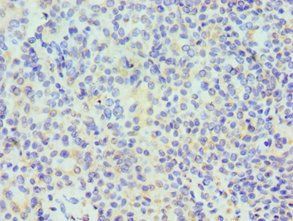 TARDBP Antibody
