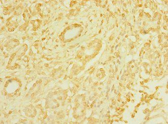 TAS1R3 Antibody