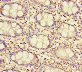 TAS2R13 Antibody