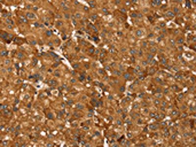 TBC1D1 Antibody
