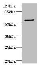TBCE Antibody