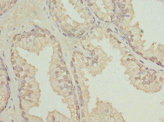TBCE Antibody