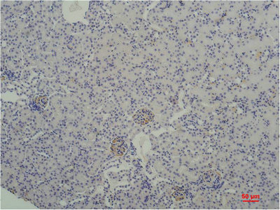 TBP Antibody