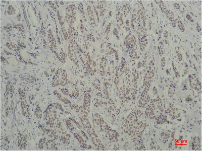TBP Antibody
