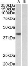 TBP /Transcription factor IID (aa39-50) Antibody