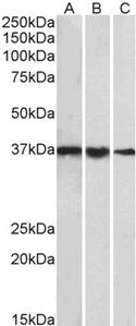 TBP /Transcription factor IID (aa39-50) Antibody