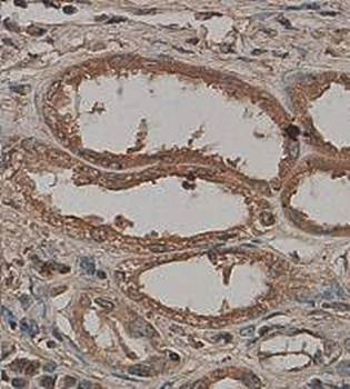 TBPL1 Rabbit Polyclonal Antibody