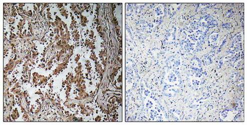 TBPL2 Antibody