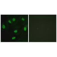 TBX15/TBX18 Antibody