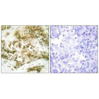 TBX15/TBX18 Antibody