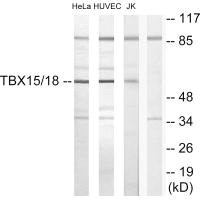 TBX15/TBX18 Antibody