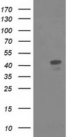 TBXAS1 Antibody