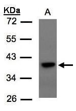 TCF19 Rabbit Polyclonal Antibody