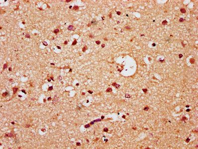 TCF20 Antibody
