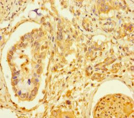 TCF4 Antibody