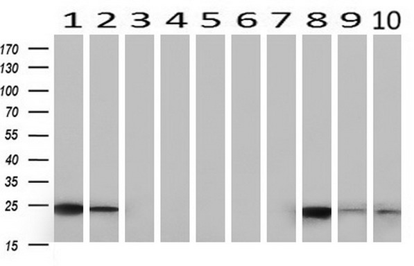 TCP1 delta Antibody