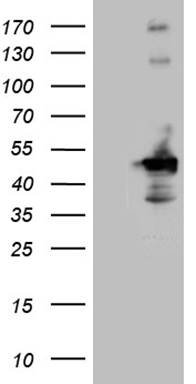 TCP1 delta Antibody