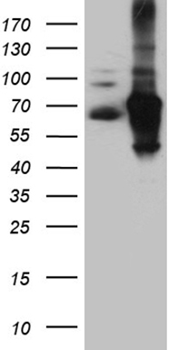 TCP1 delta Antibody
