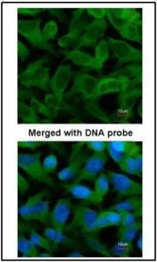 TCP1 epsilon Rabbit Polyclonal Antibody