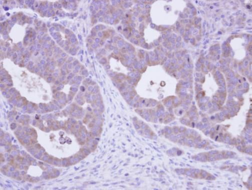 TCP1 epsilon Rabbit Polyclonal Antibody