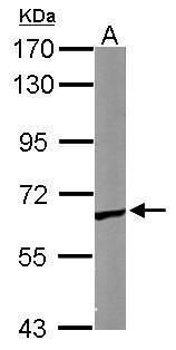 TCP1 epsilon Rabbit Polyclonal Antibody