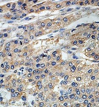 TDGF1 Rabbit Polyclonal Antibody