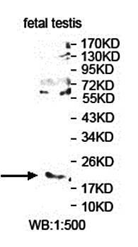 TDGF1 Rabbit Polyclonal Antibody