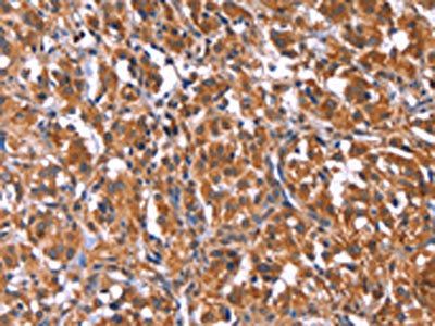 TDP2 Antibody