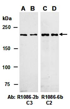 TET2 (vPairTM) Antibodies