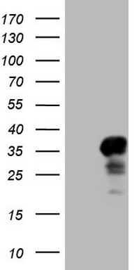 TET3 Antibody