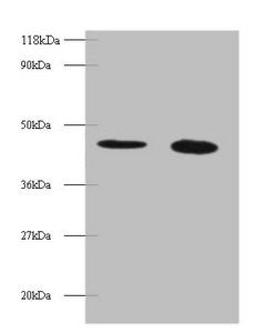 TTC1 Antibody