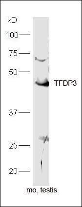 TFDP3 Rabbit Polyclonal Antibody