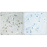 TFE3 Antibody