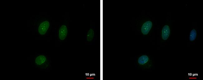 TFEC Rabbit Polyclonal Antibody