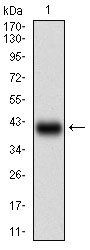 TFF2 Antibody
