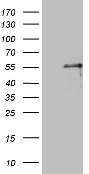 GTF2B Antibody