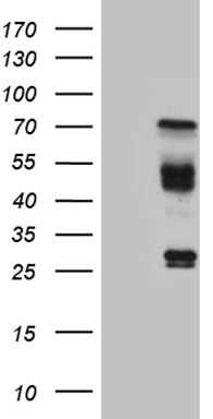 GTF2B Antibody