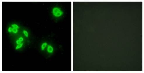 TFIP8 Antibody