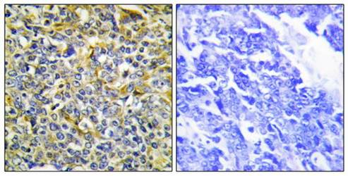 TFIP8 Antibody