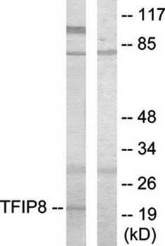 TFIP8 Antibody