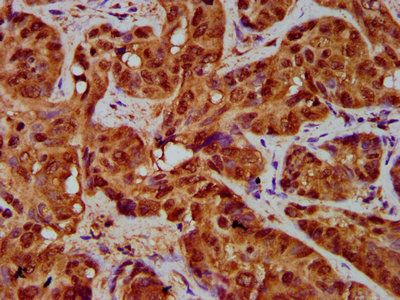 TFR2 Antibody