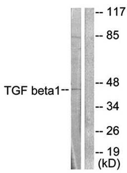 TGF β1 Antibody