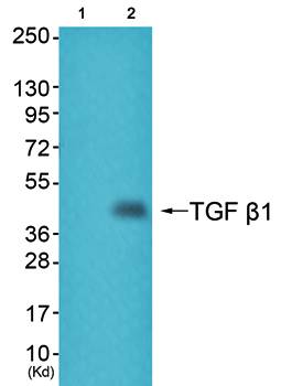 TGF β1 Antibody