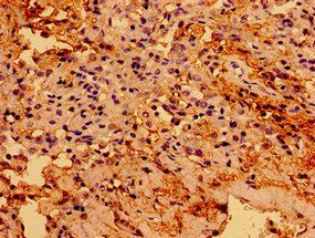 TGFB1I1 Antibody