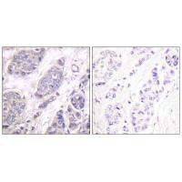 TGFB3 Antibody