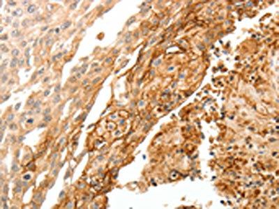 TGM1 Antibody