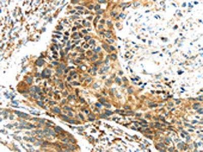 TGM4 Antibody