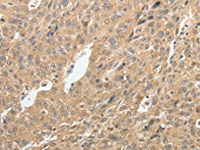TH Antibody