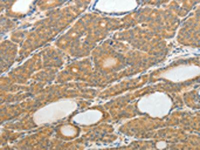 TH Antibody